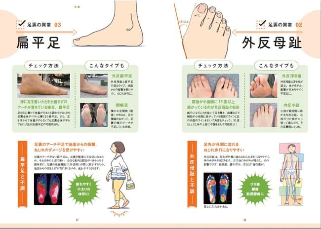 ↑中高年にとって「あるある」な足の異常。いわば現代日本の“３大悪い足”とも言える「浮き指」「外反母趾」「扁平足」